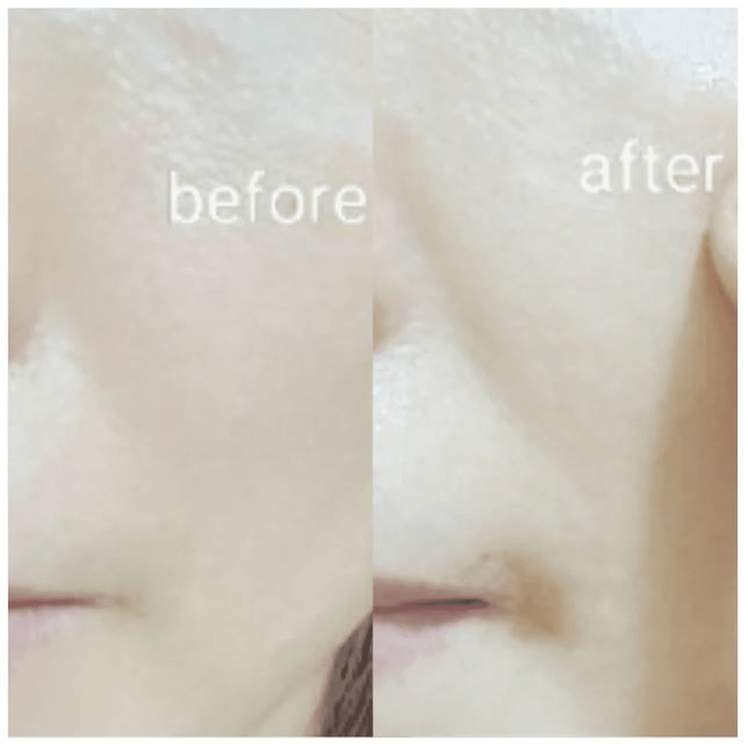 COCOBO Sheet Mask Kit (12 Units) - Expert Cosmetics